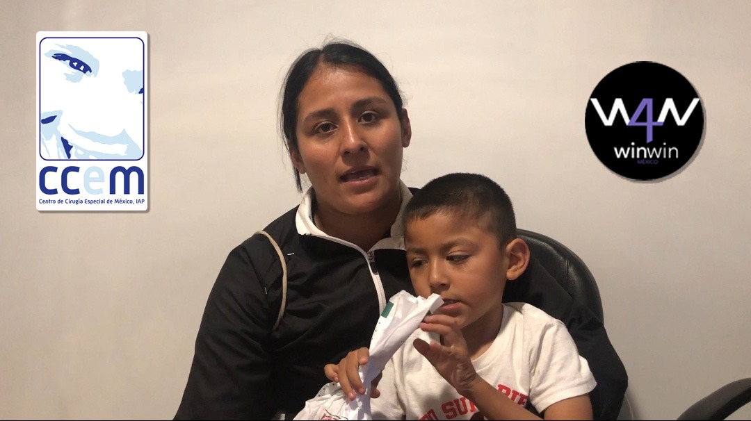 Cirugías gratuitas para mejorar la vida de los niños
