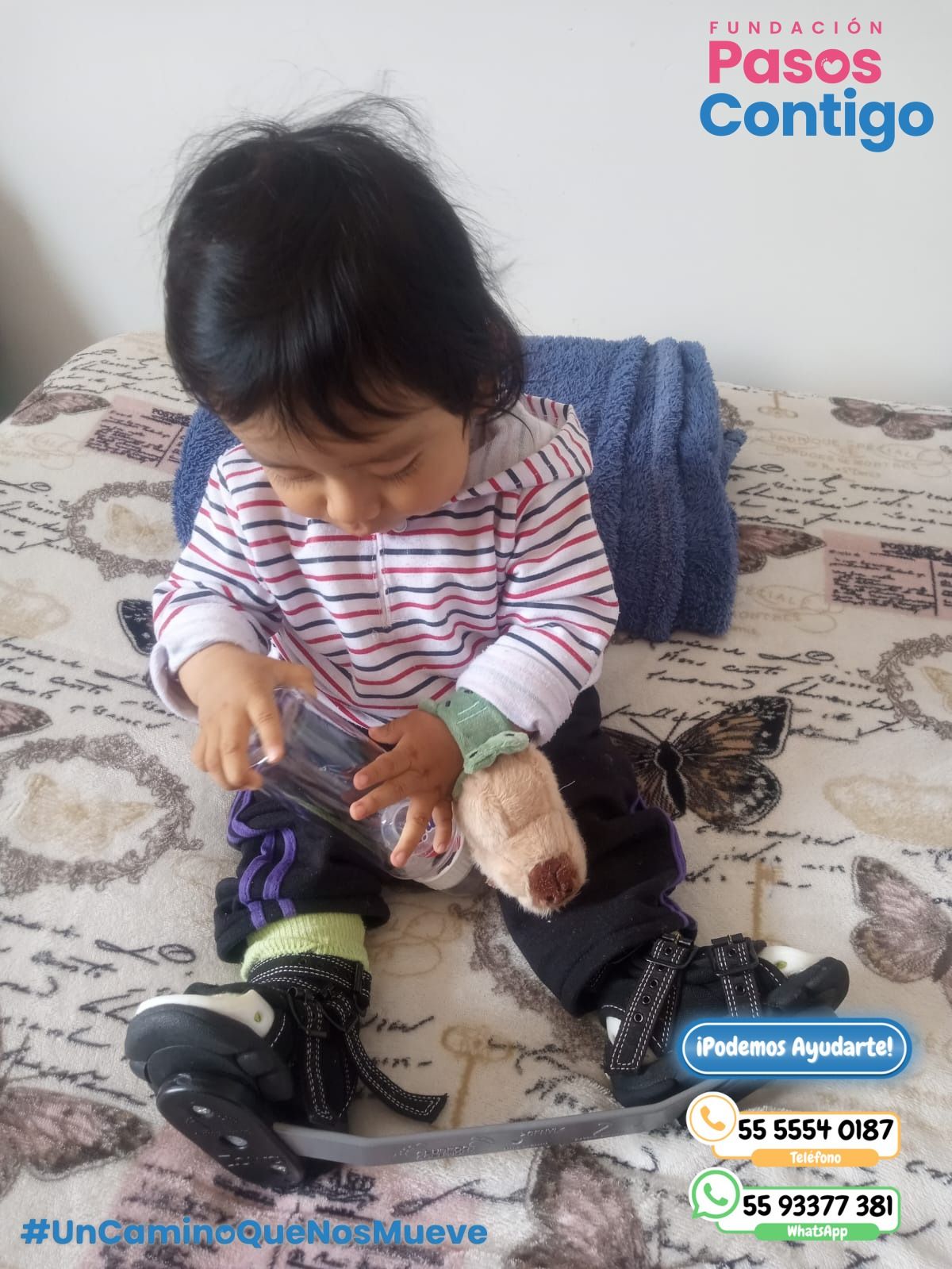 ¿Pie equino varo (PEVA)? ¿Qué es?