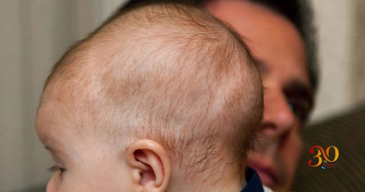 Craneosinostosis en la infancia: el trabajo que transforma diagnósticos en oportunidades de vida