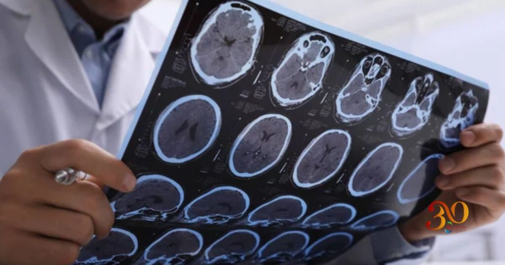 Día del Neurocirujano