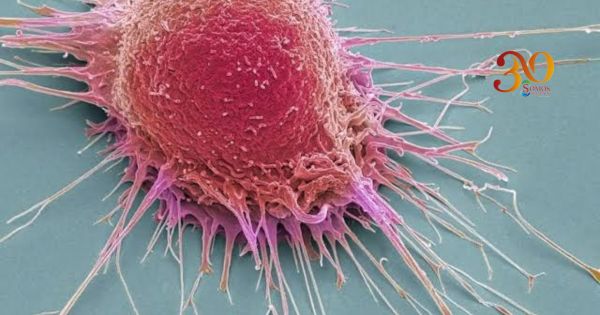 Innovación Médica y Solidaridad Social: Los Nuevos Horizontes en la Lucha contra el Cáncer en México